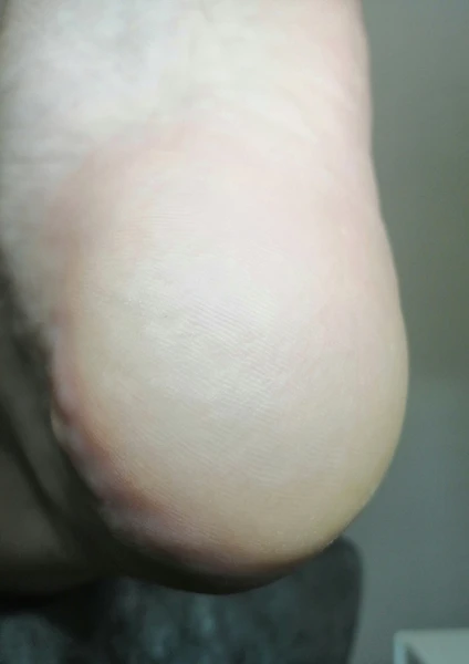 &