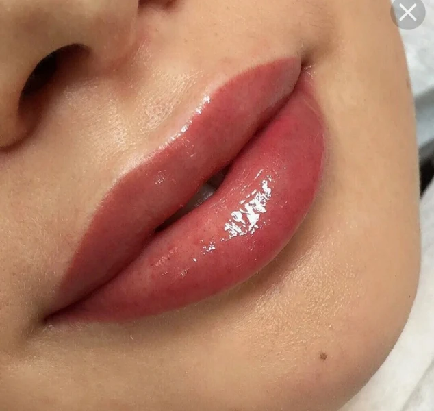 &