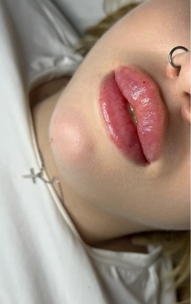 &
