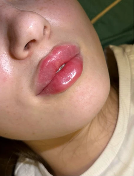 &