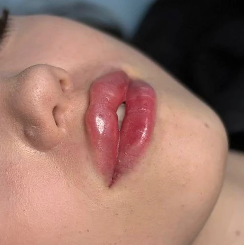 &