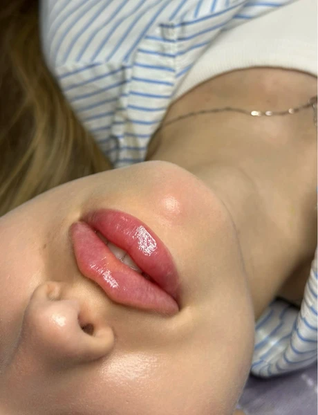 &