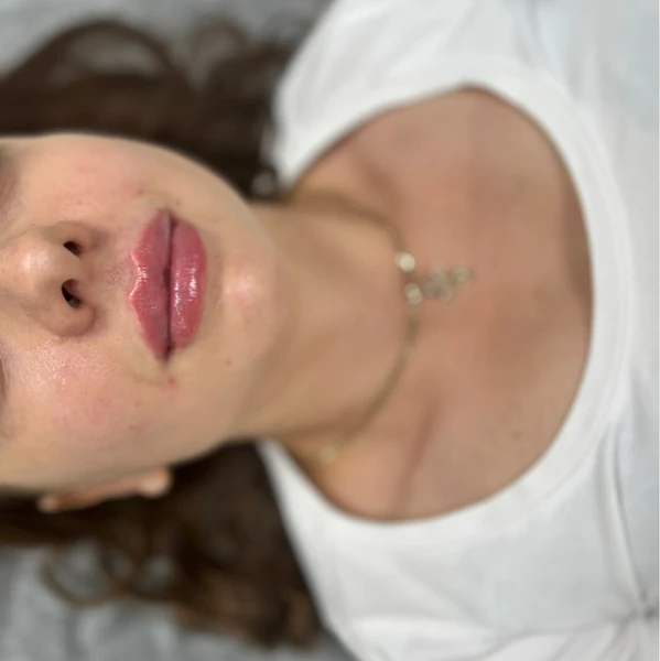 &