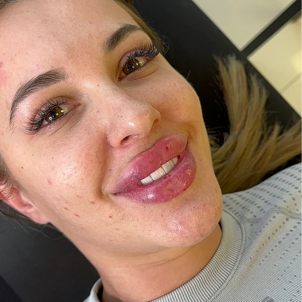 &