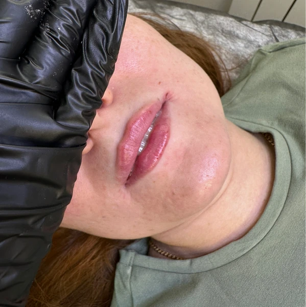 &