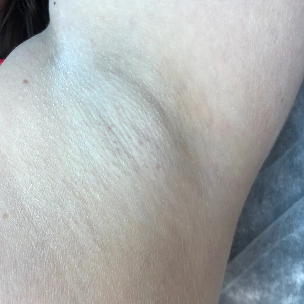 &