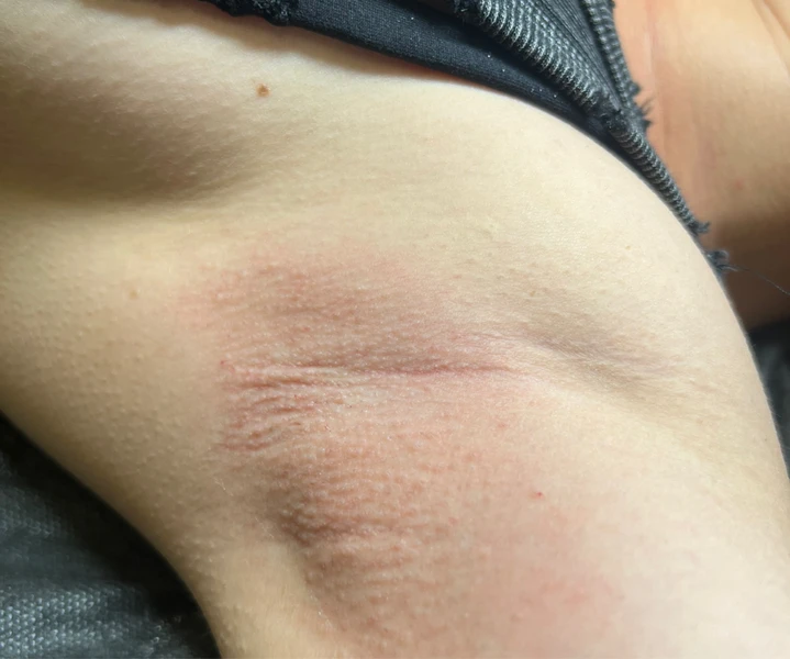 &