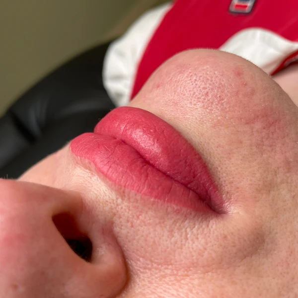 &