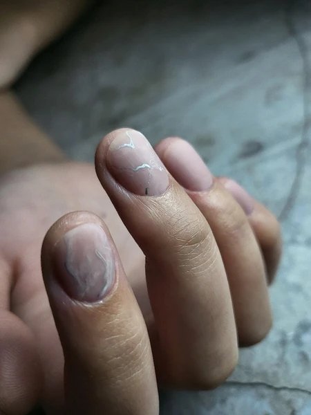 &