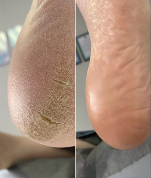 &