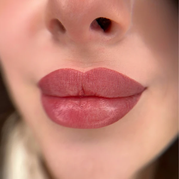 &
