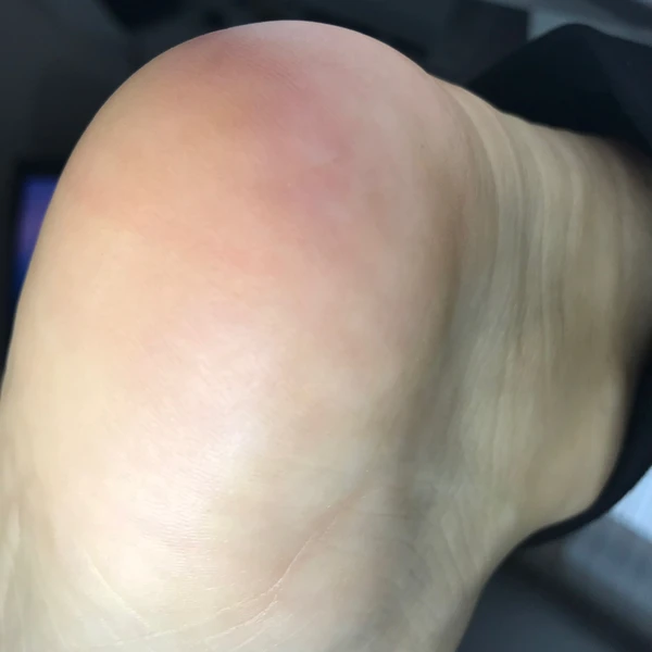 &