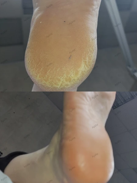 &