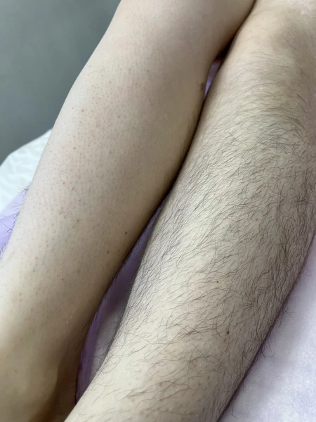 &