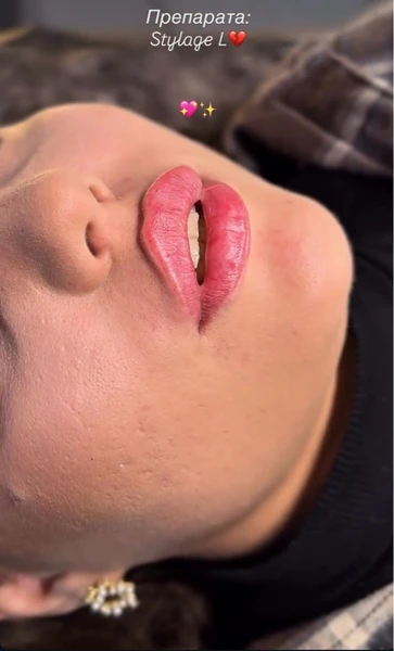 &