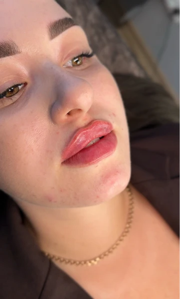 &