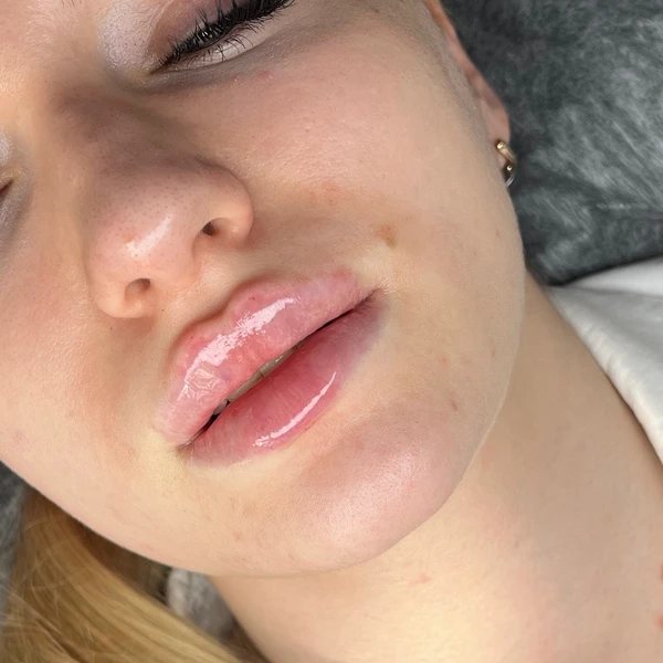 &