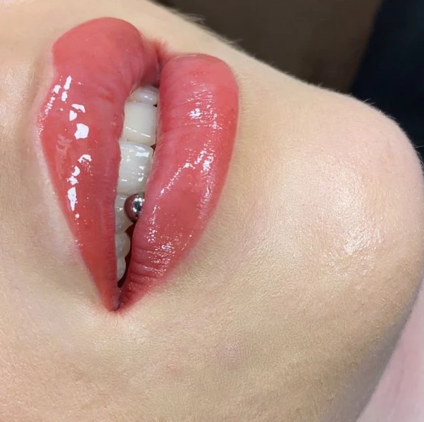 &