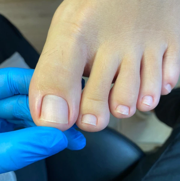 &
