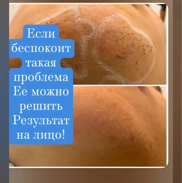 &