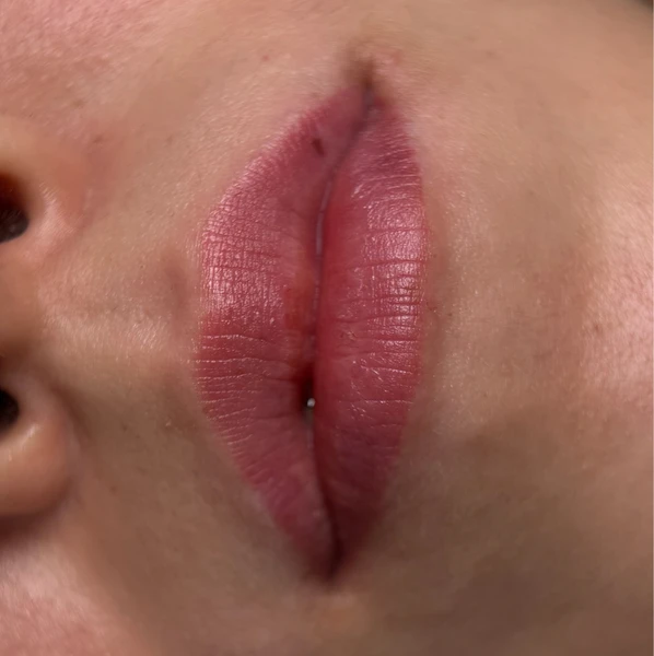 &