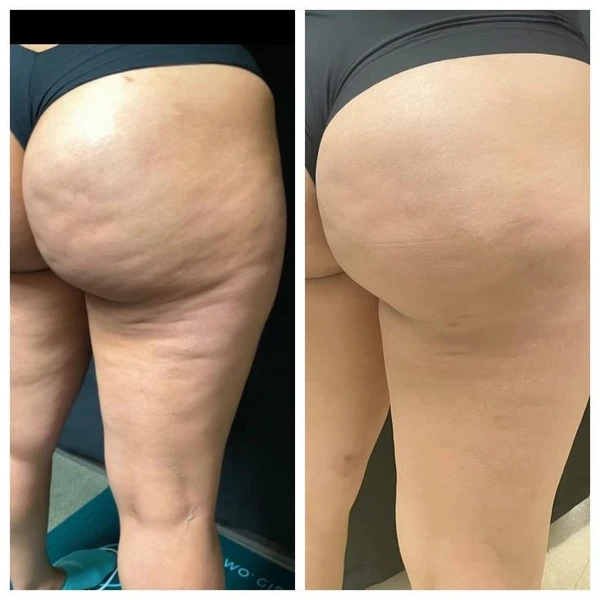 &