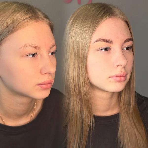 &