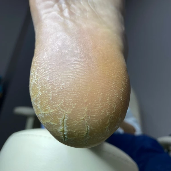 &