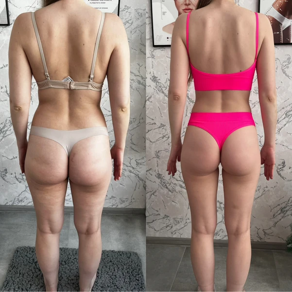 &