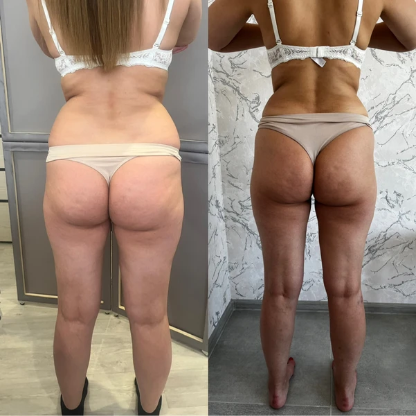 &