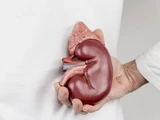 &