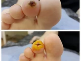 &