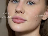 &