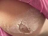 &