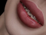 &