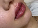 &