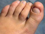 &