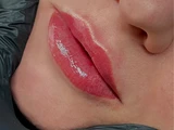 &