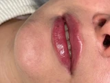 &