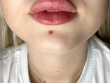 &