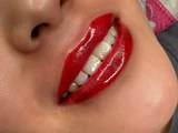 &