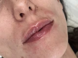 &