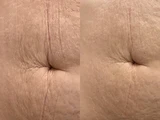 &