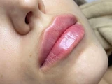 &