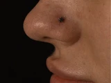 &