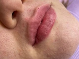 &