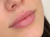 &