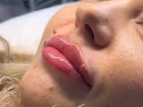&