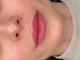 &
