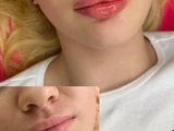 &